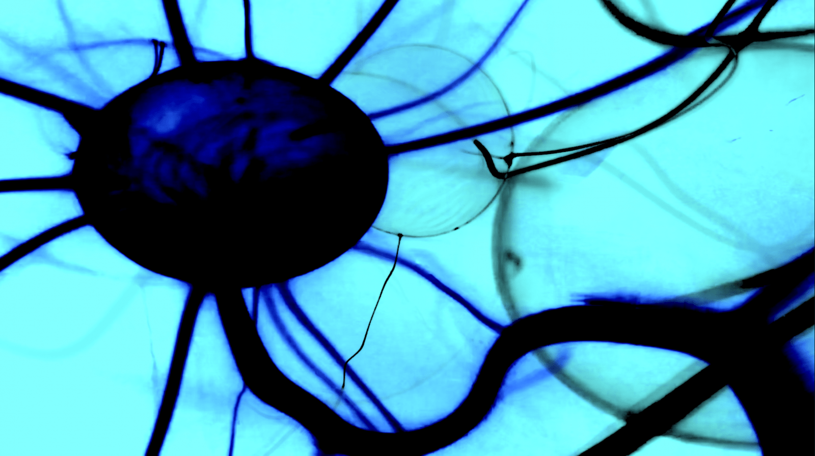 Digital print on aluminum from video series diving into neurobiology (ongoing series)