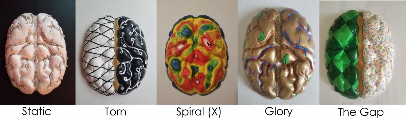 series of plaster cast brains related to various mental health aspects